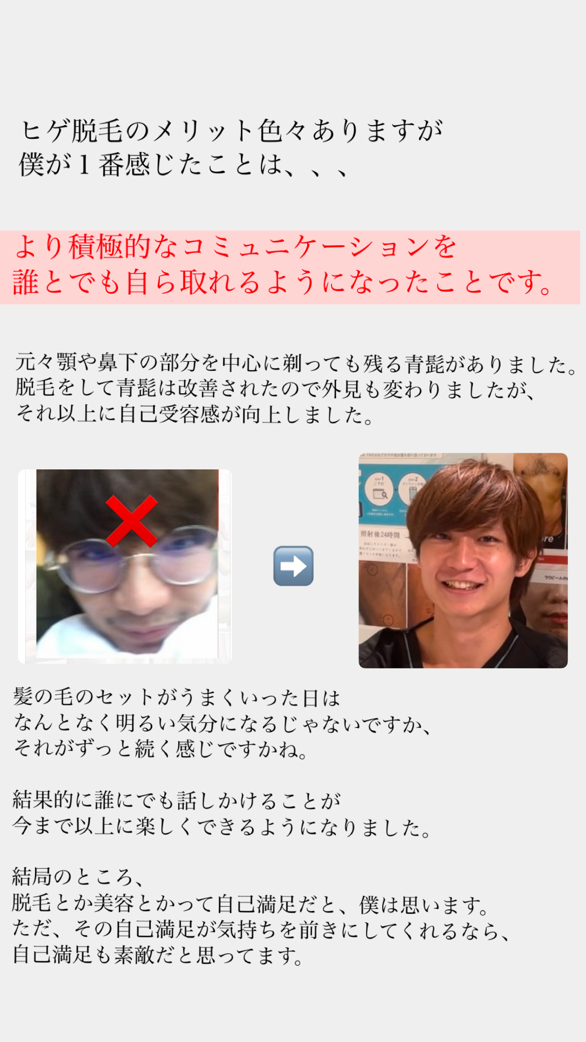 【ヒゲ脱毛】僕が感じた1番のメリット